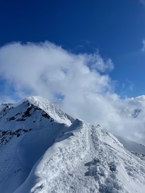 Is Whistler Worth Visiting? My Honest Review (2025)